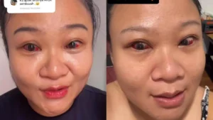 Usai Operasi Mata, Desta Disemprot Miskha Sang Putri Usai Viral Gelendotan dengan Wanita Lain